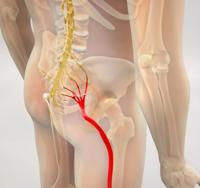 Bacağa Vuran Bel Fıtığı Tedavisi