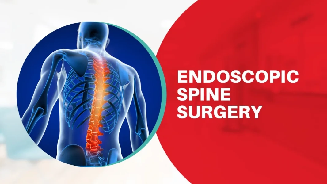 Endoskopik omurga ameliyatı kimler için uygundur?