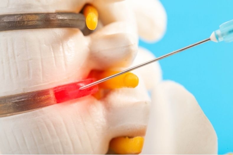 Omurga Ağrılarında Enjeksiyon Tedavisi